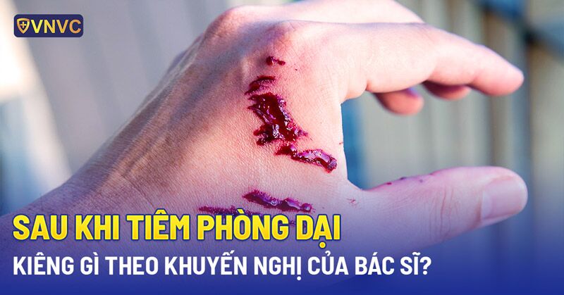 tiêm phòng dại kiêng gì