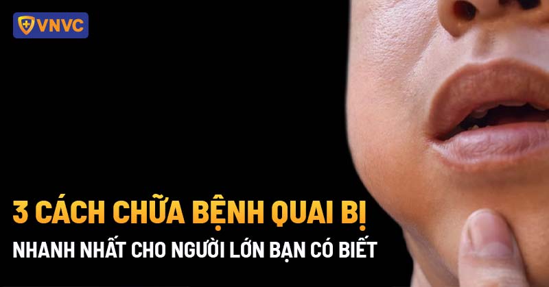 cách chữa bệnh quai bị nhanh nhất