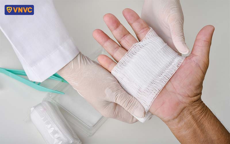 sơ cứu khi bị chó cắn