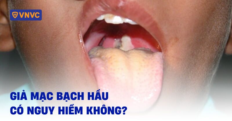 giả mạc bạch hầu