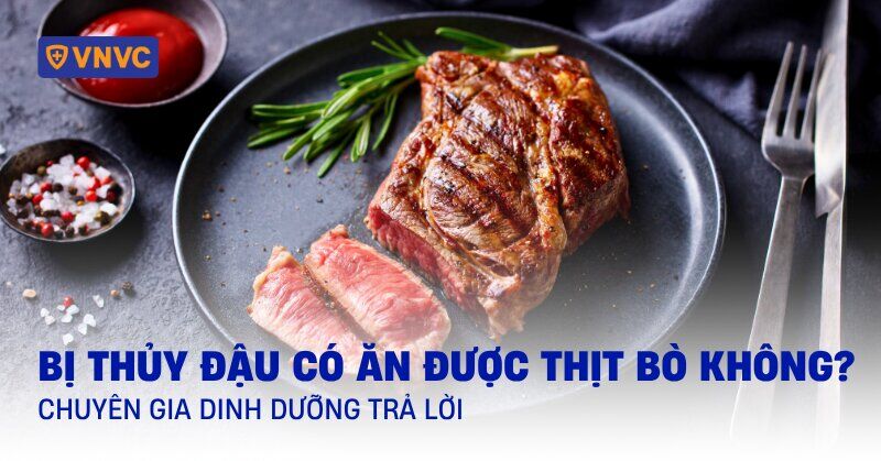 Người đang bị thủy đậu ăn thịt bò được không?